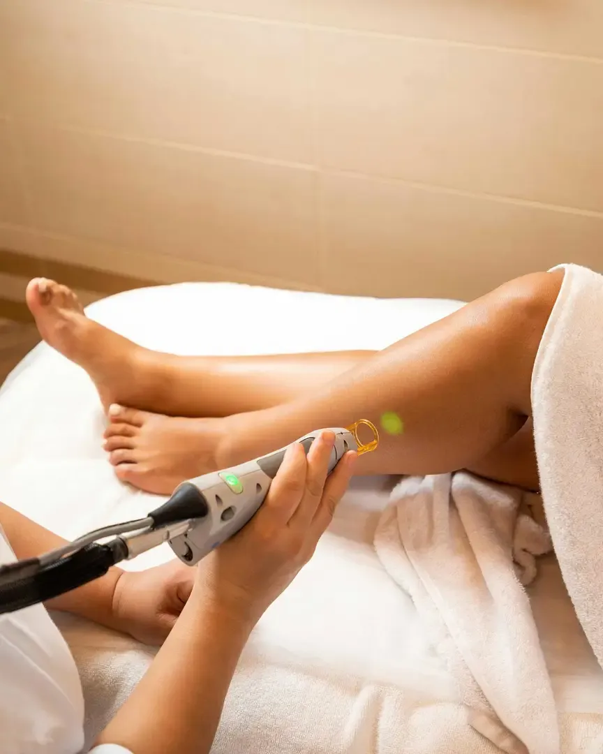 Experiența mea cu epilarea definitiva IPL: tot ce trebuie să știi înainte de a începe